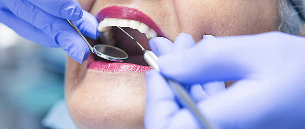 Best Broken or Cracked Tooth Emergency Dentist in Meadow Woods, FL